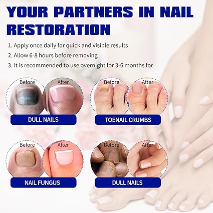 Fungal Nail Treatment 10 Patches
