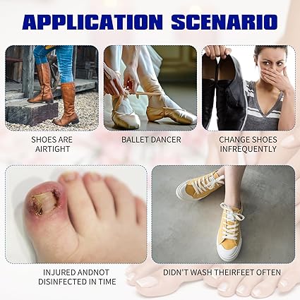 Fungal Nail Treatment 10 Patches