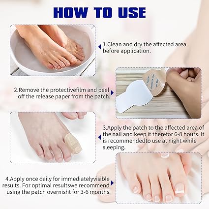 Fungal Nail Treatment 10 Patches