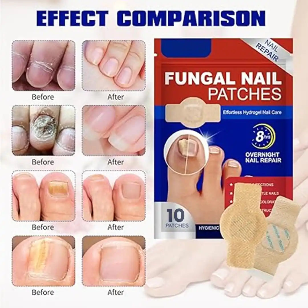 Fungal Nail Treatment 10 Patches
