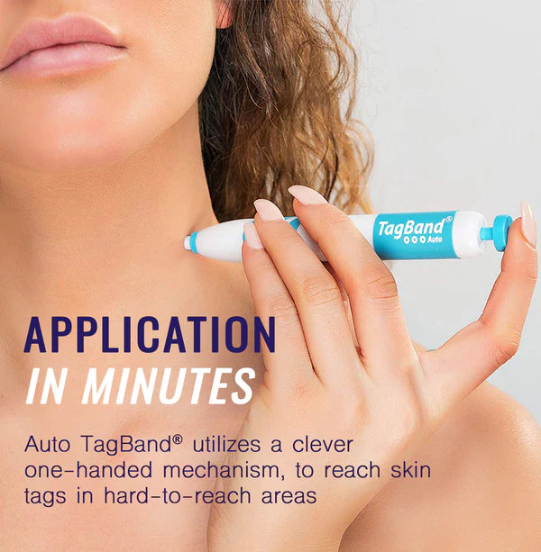 Painless Mole Wart Remover