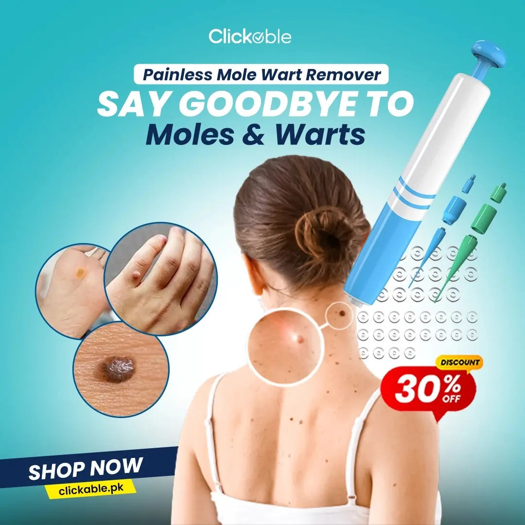 Painless Mole Wart Remover