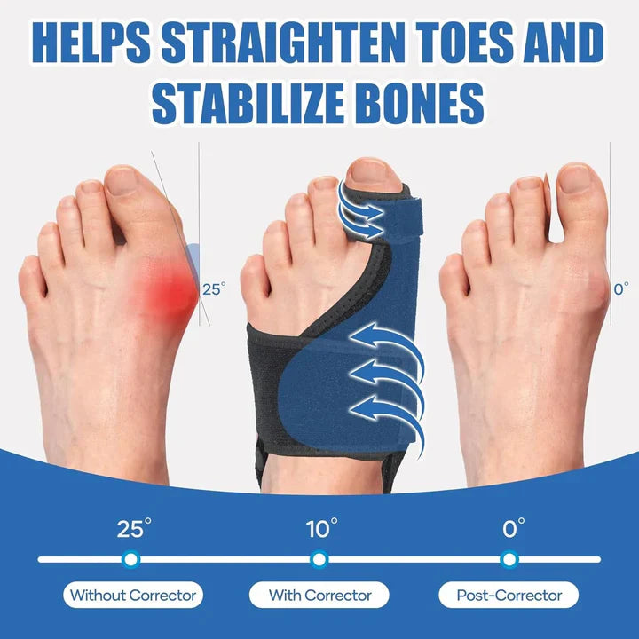 Neoprene Adjustable Bunion Toe Corrector