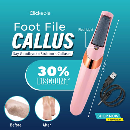Foot File Callus